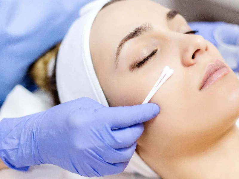 Dark spots and melasma Puebla