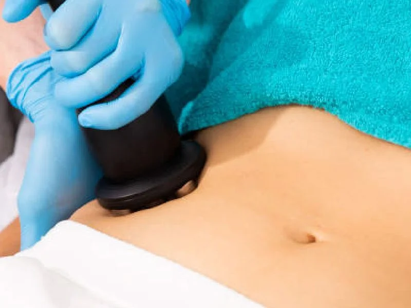 Radiofrequency facial Puebla